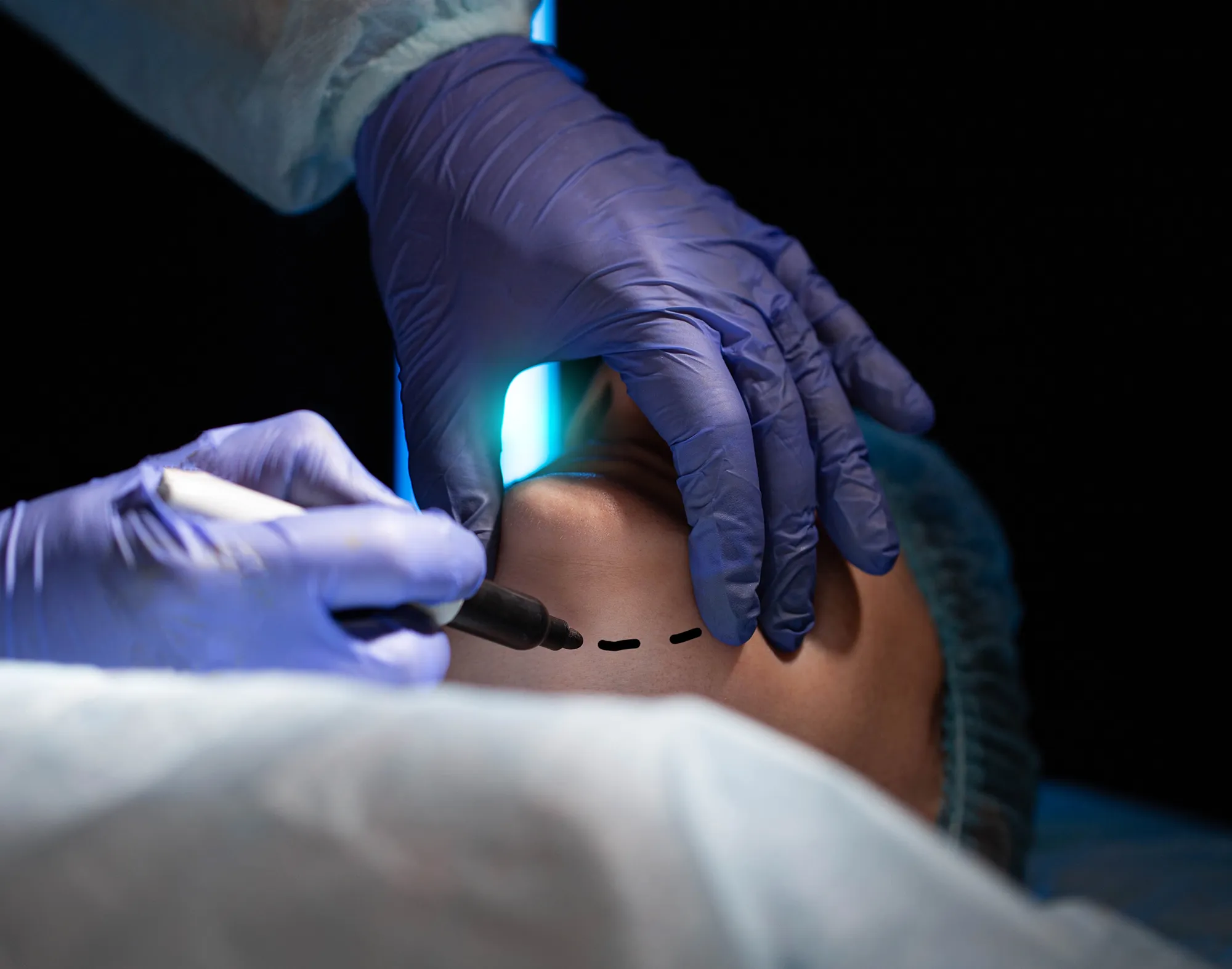 la chirurgie orthognathique à Nancy