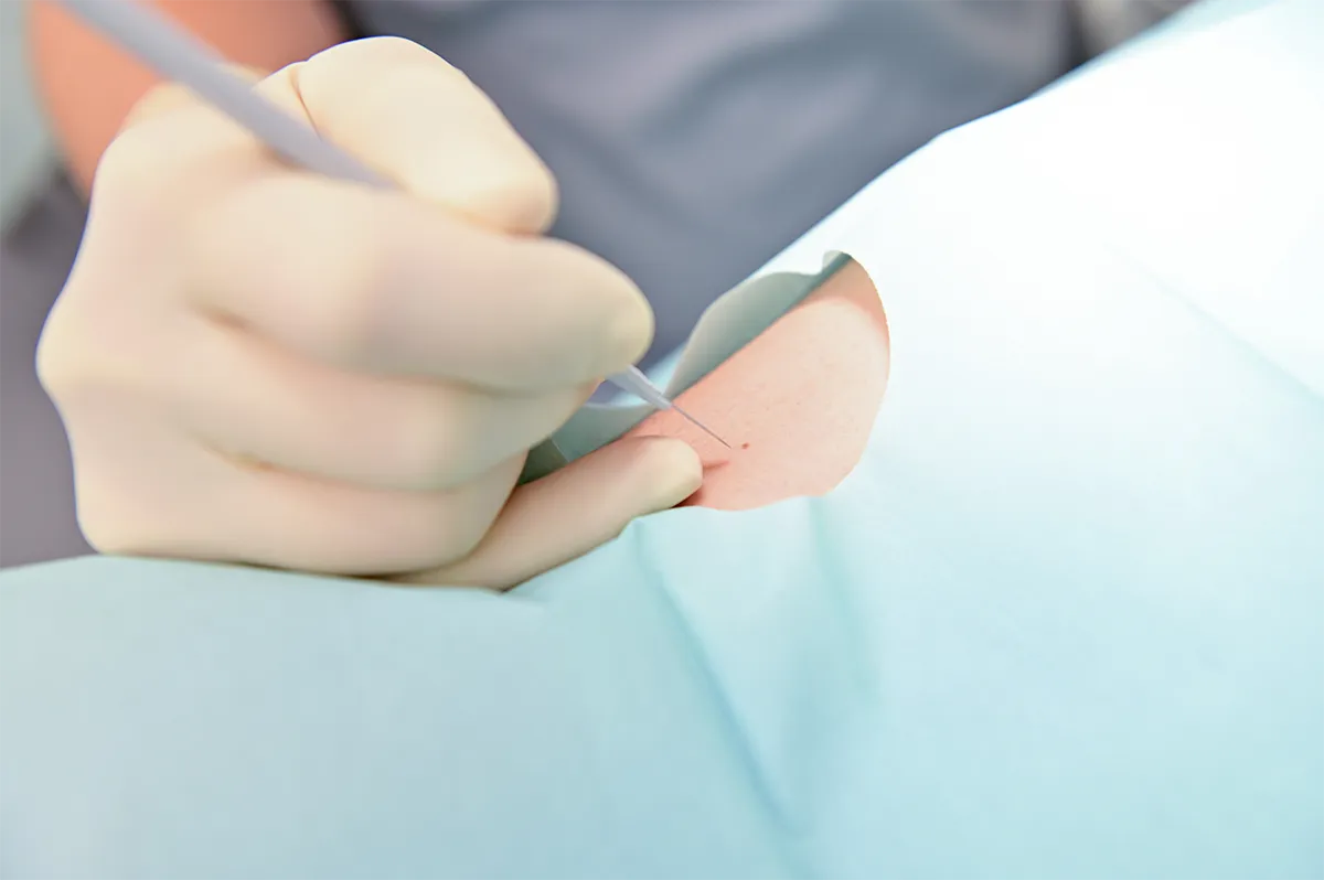 Chirurgie cutanée à la clinique lorraine du visage à Nancy