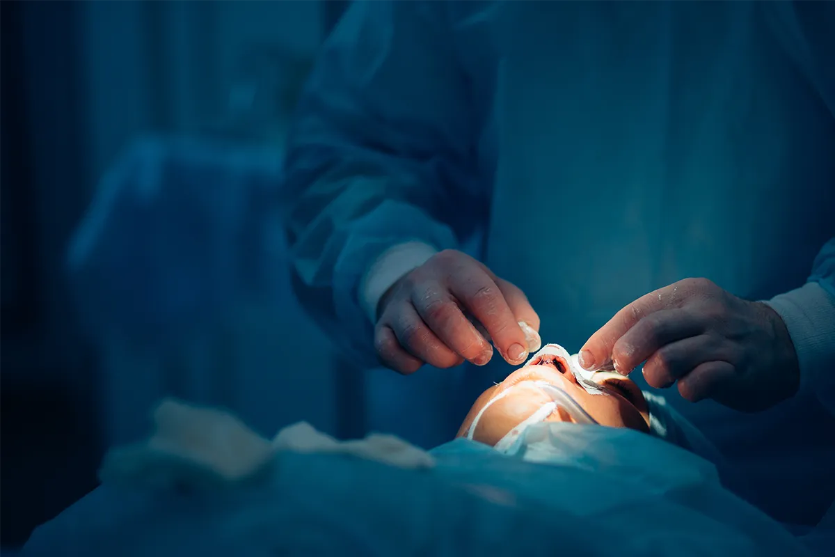 Septorhinoplastie à Nancy