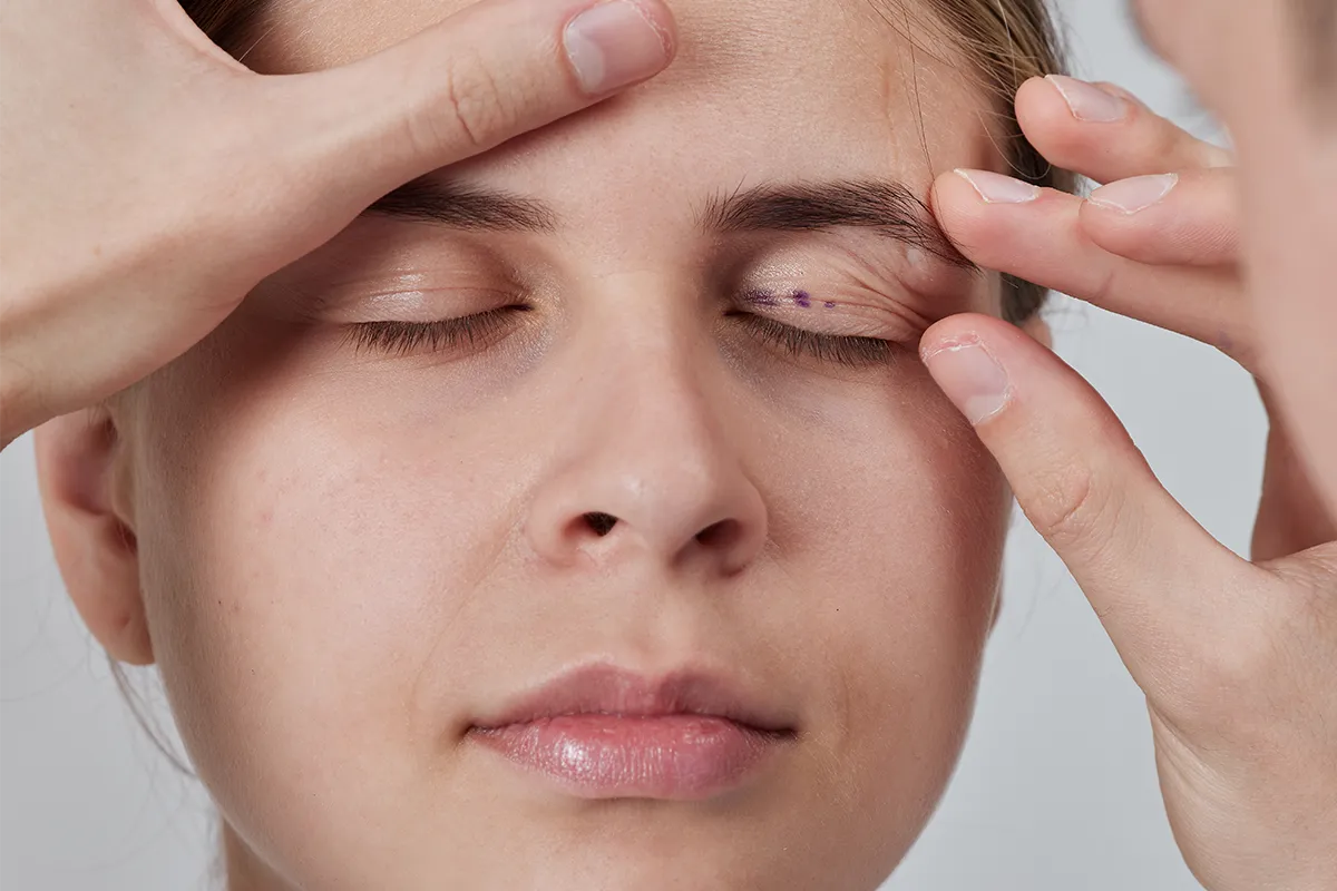 la blépharoplastie à la clinique lorraine du visage à Nancy