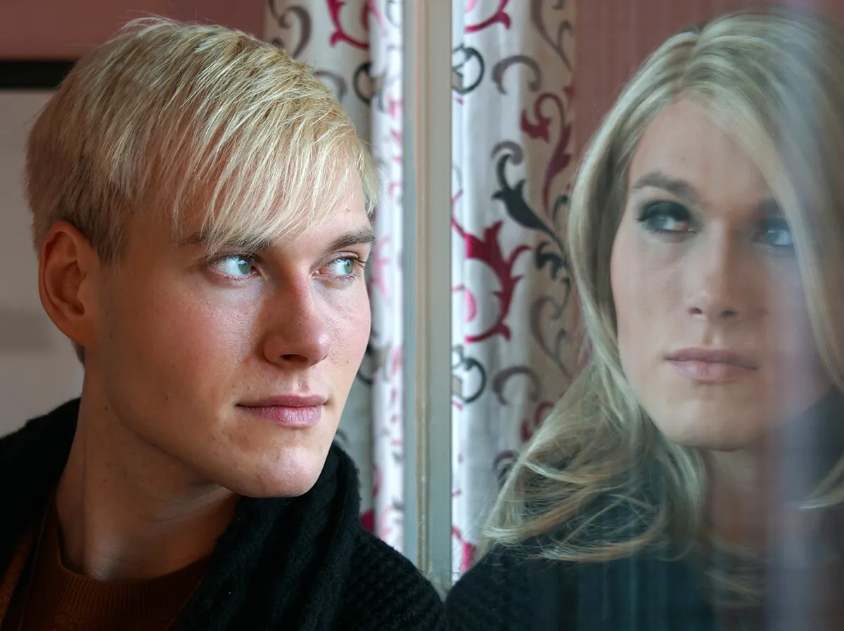 La chirurgie de féminisation du visage (FFS)