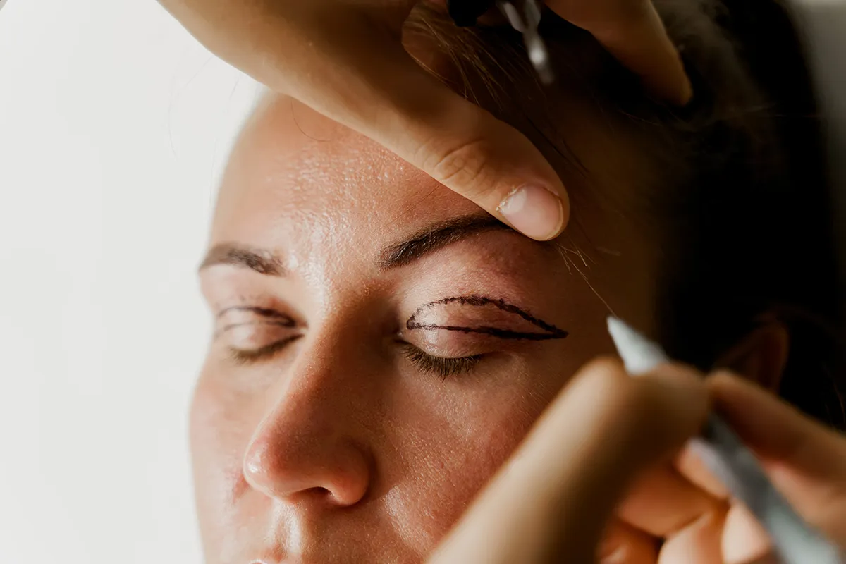 la blépharoplastie à la clinique lorraine du visage à Nancy
