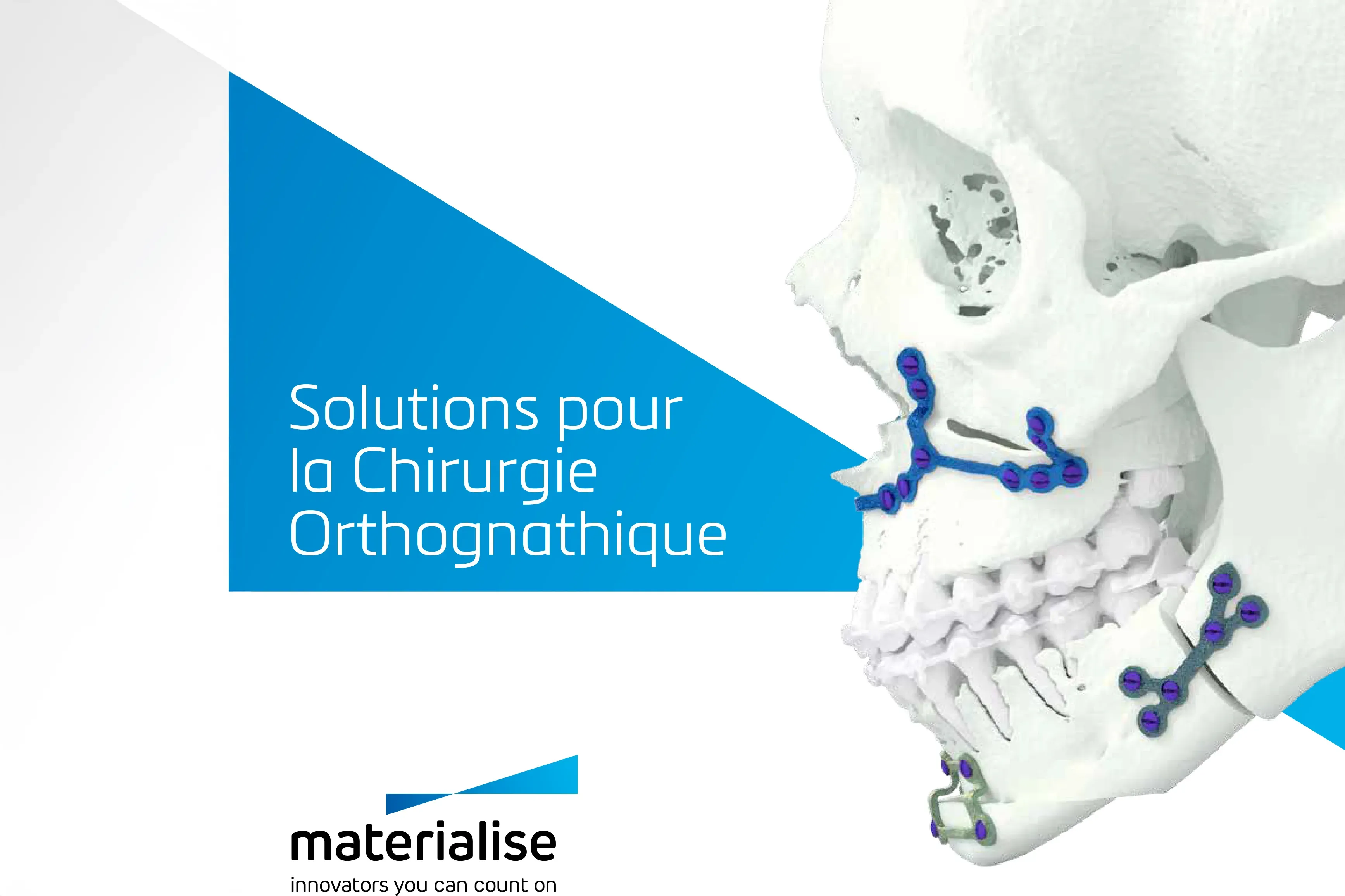 la chirurgie orthognathique à Nancy