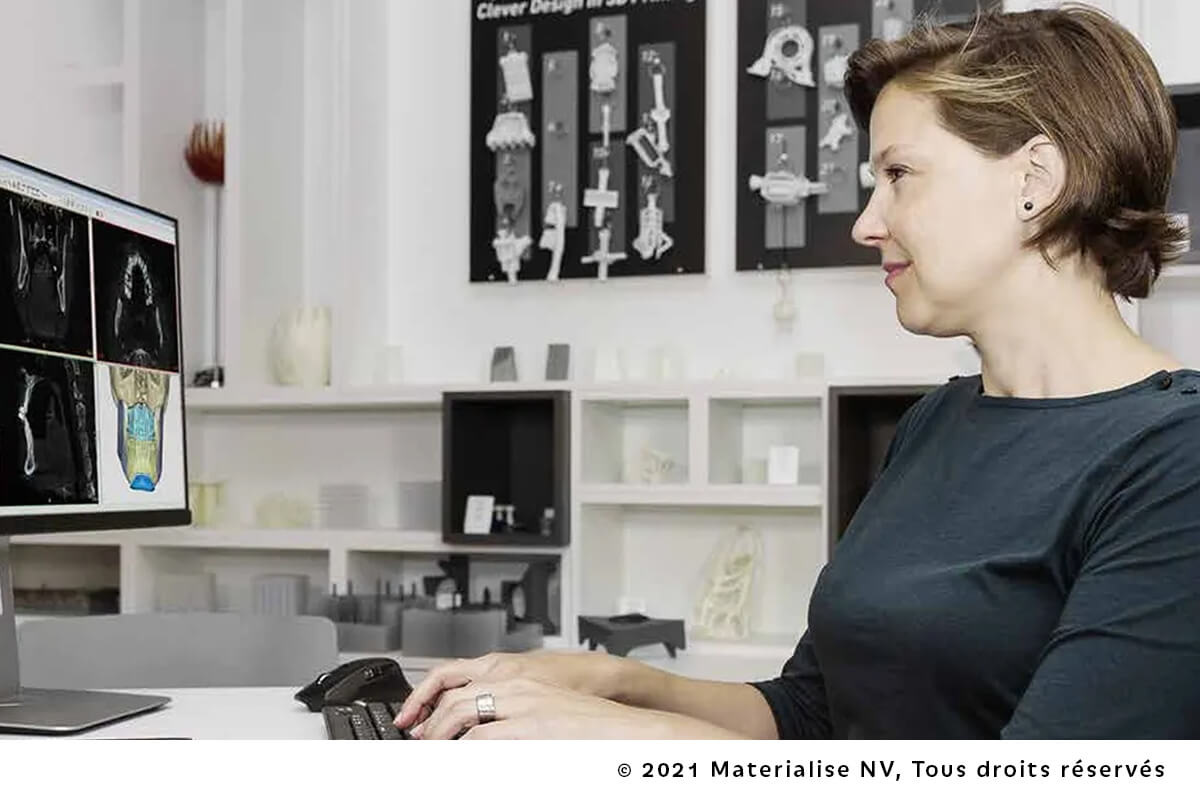Planification Virtuelle & Dispositifs Sur Mesure en Chirurgie Orthognathique